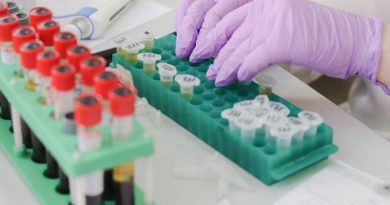 Know About Immunoassay and ELISA