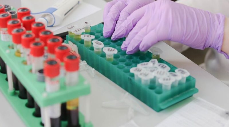 Know About Immunoassay and ELISA