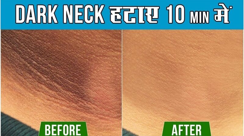 Clean Black Neck Spots