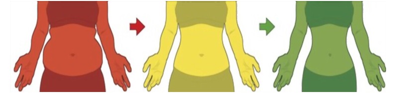 Things to Know About Liposuction