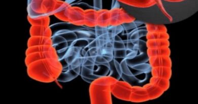 Appendix Operation cost in Hyderabad