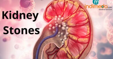 Kidney Stones