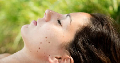 Four Common Skin Problems and What They May Mean