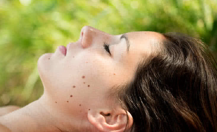 Four Common Skin Problems and What They May Mean