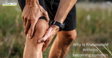 Rheumatoid Arthritis