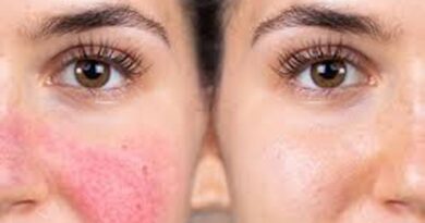 Exploring Non Invasive Solutions for Facial Redness Treatment